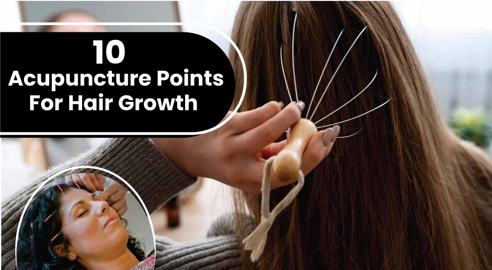 Get Luscious Locks With 10 Acupuncture Points For Hair Growth That Could Transform Your Hairline!