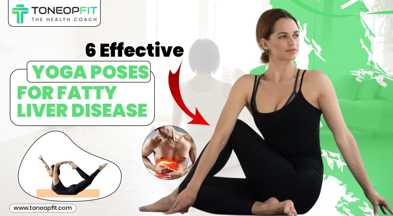 6 Effective Yoga Poses For Fatty Liver Disease & Tips To Manage It Naturally!