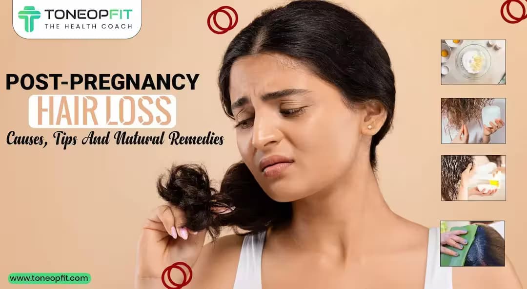 Are You Battling Post-Pregnancy Hair Loss? Uncover Causes, Top Tips And Natural Remedies To Restore Your Locks