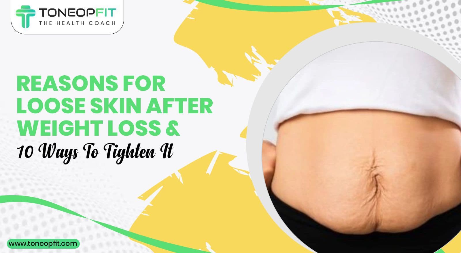 Causes Of Loose Skin After Weight Loss And 10 Ways To Tighten It