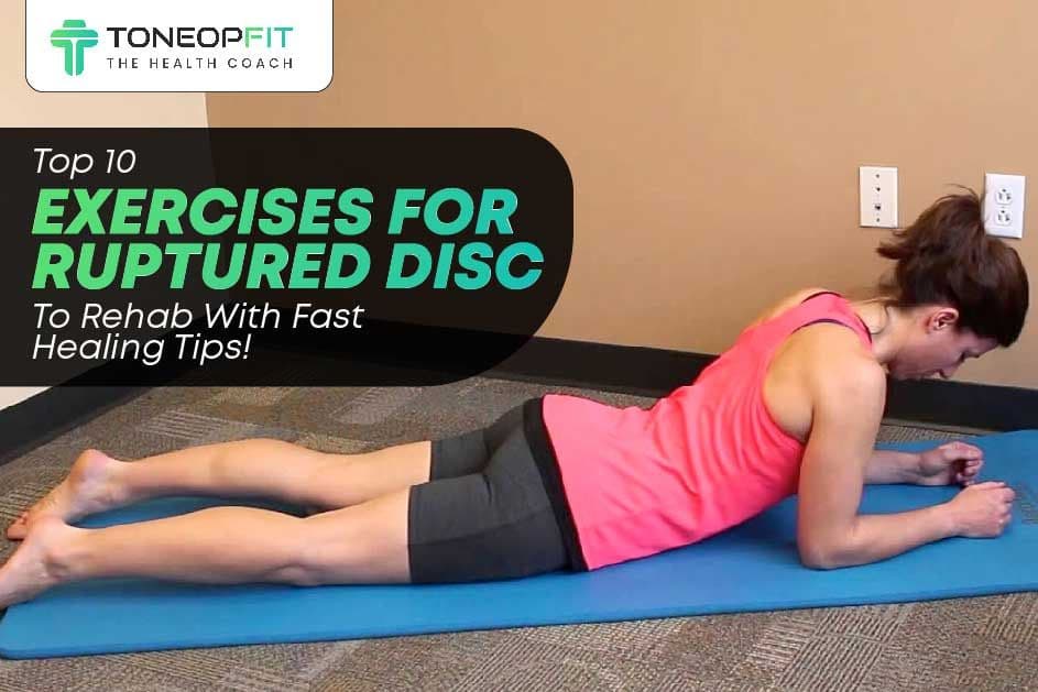 Top 10 Exercises For Ruptured Disc To Rehab With Fast Healing Tips!