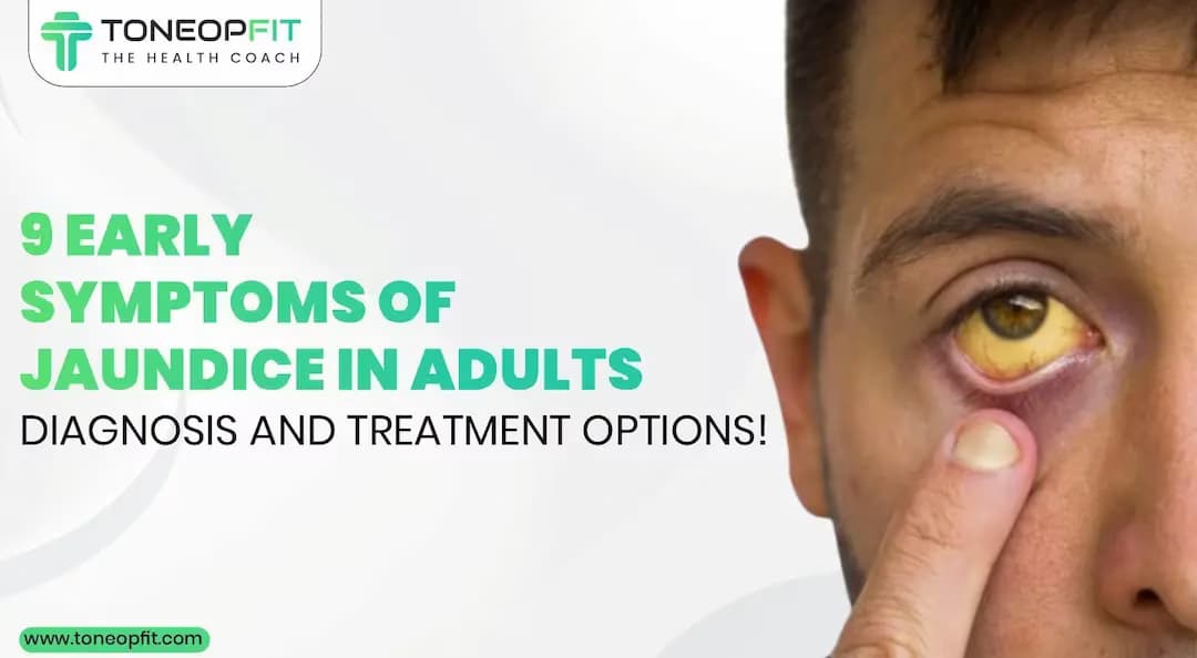9 Early Symptoms of Jaundice In Adults: Discover Diagnosis, Home Remedies, and Treatment Options!